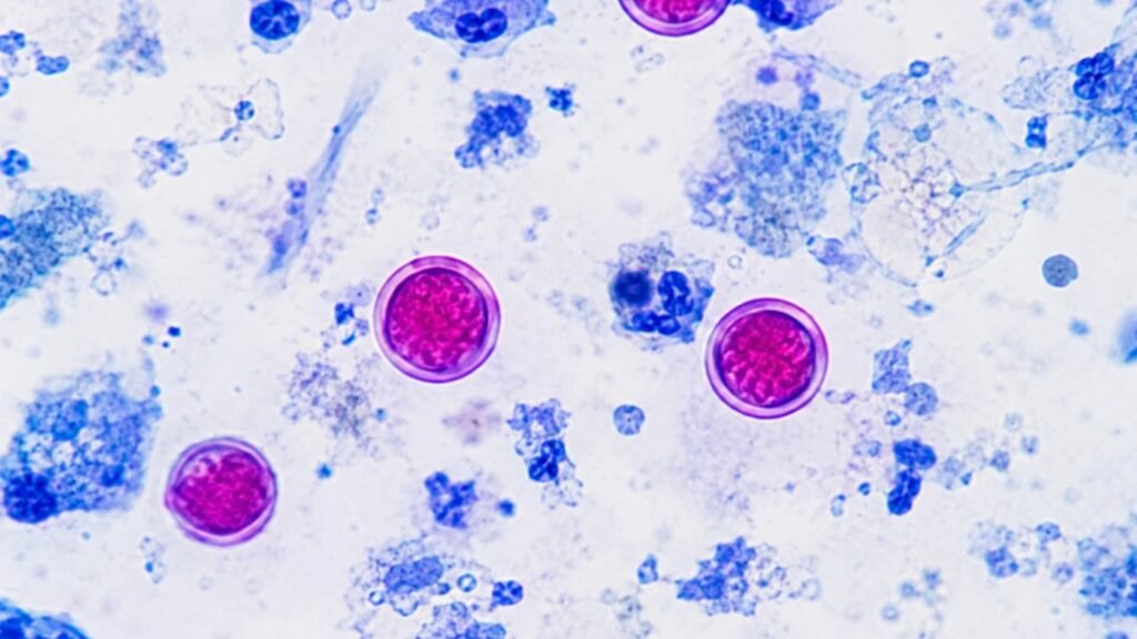 Cyclosporiasis