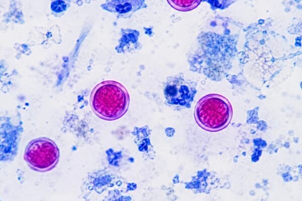 Cyclosporiasis